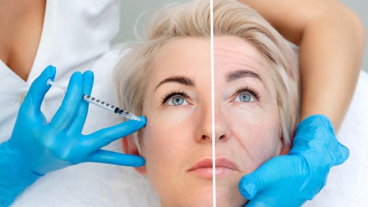 Buy dermal filler online