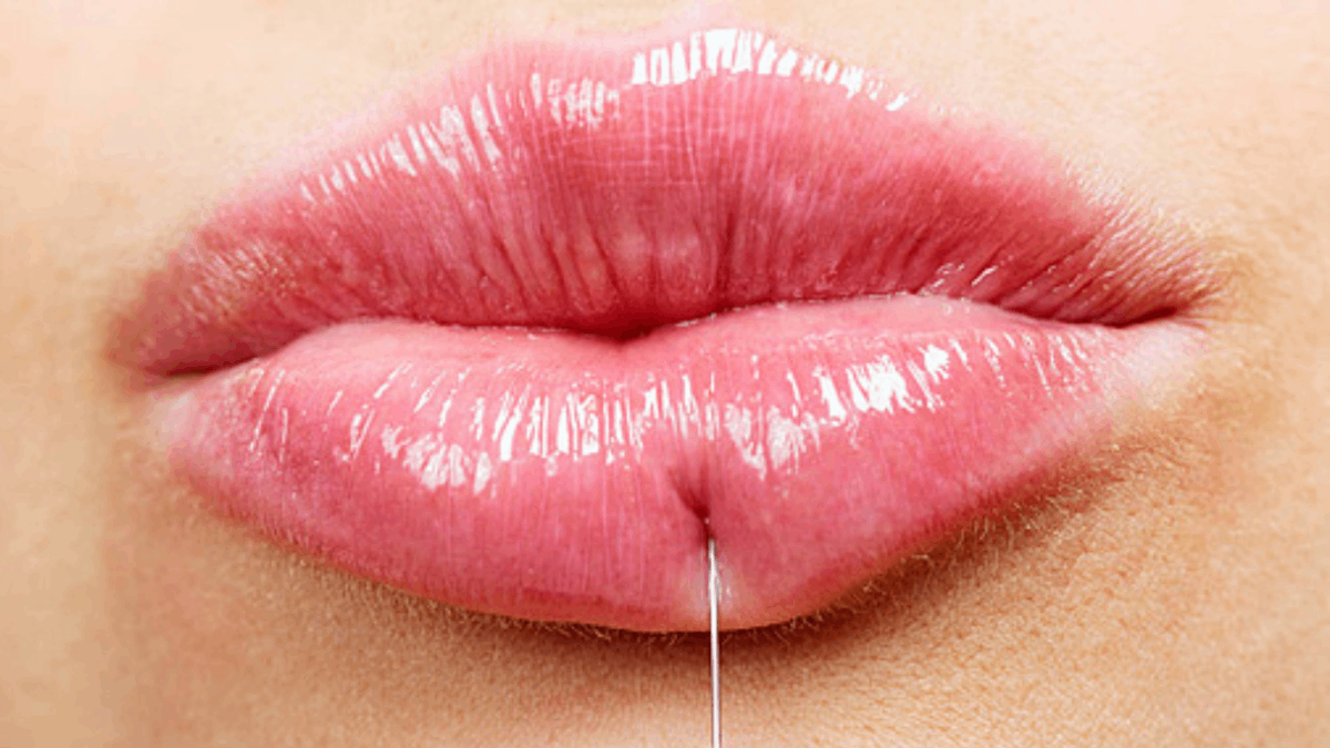 Buy lip filler online